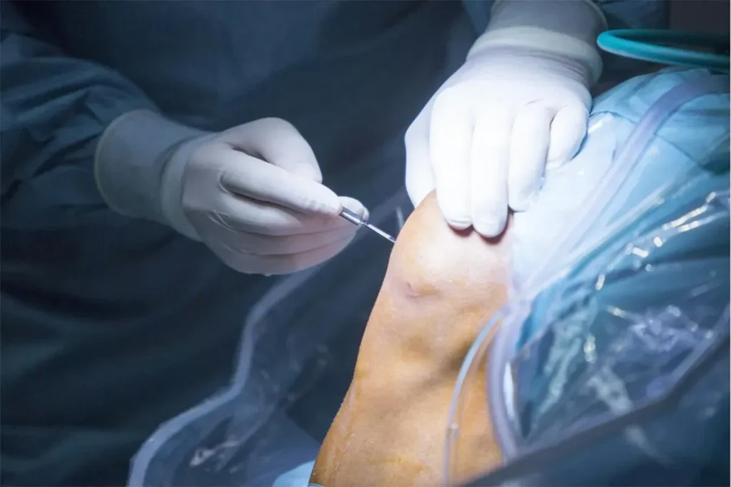 Orthopedic Surgery