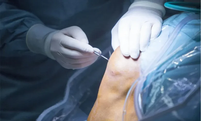 Orthopedic Surgery