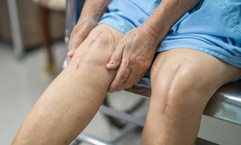 Knee Surgery