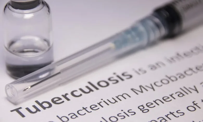 Treating Tuberculosis