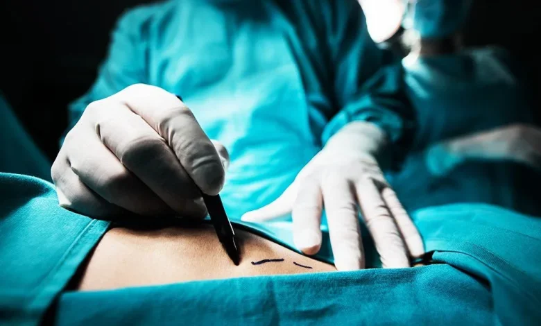 Weight Loss Surgery