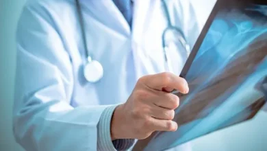 Lung Cancer Treatment